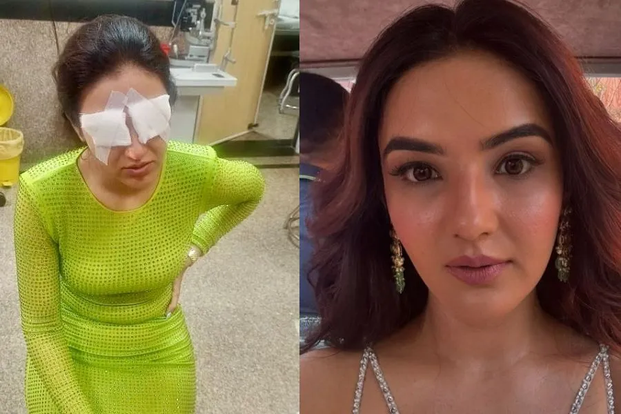 Jasmin Bhasin's cornea got damaged: her vision had stopped, there was a problem with wearing lenses"