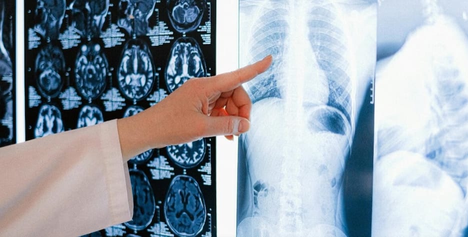 सांस फूलना हार्ट की बीमारी या फेफड़ों का संक्रमण? जानें अंतर